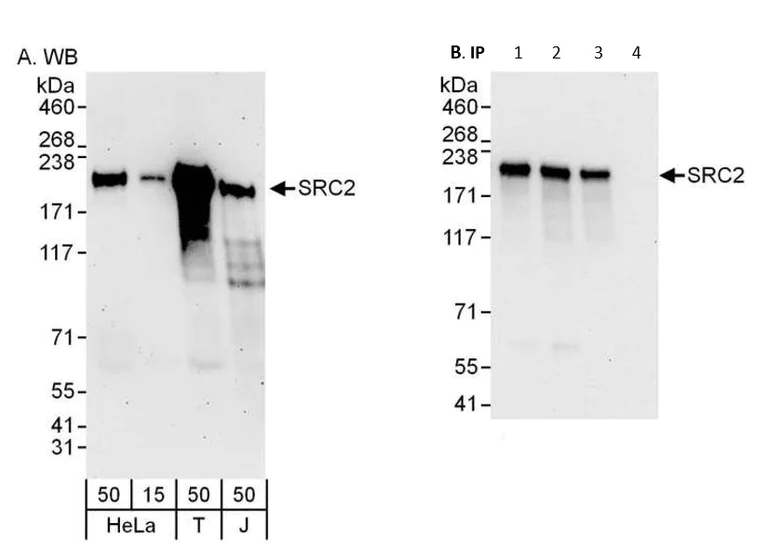 Immunoprecipitation - Anti-KAT13C / NCOA2 antibody (AB10491)