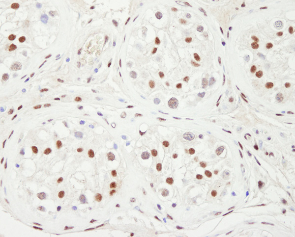 Immunohistochemistry (Formalin/PFA-fixed paraffin-embedded sections) - Anti-KAT13C / NCOA2 antibody (AB10508)