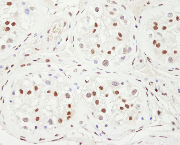 Immunohistochemistry (Formalin/PFA-fixed paraffin-embedded sections) - Anti-KAT13C / NCOA2 antibody (AB10508)