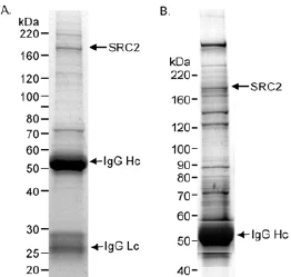 Immunoprecipitation - Anti-KAT13C / NCOA2 antibody (AB10508)