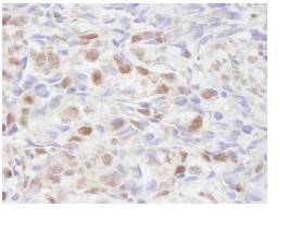 Immunohistochemistry (Formalin/PFA-fixed paraffin-embedded sections) - Anti-KAT13C / NCOA2 antibody (AB84140)