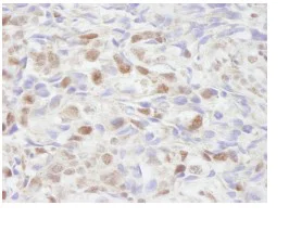 Immunohistochemistry (Formalin/PFA-fixed paraffin-embedded sections) - Anti-KAT13C / NCOA2 antibody (AB84140)