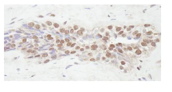 Immunohistochemistry (Formalin/PFA-fixed paraffin-embedded sections) - Anti-KAT13C / NCOA2 antibody (AB84140)