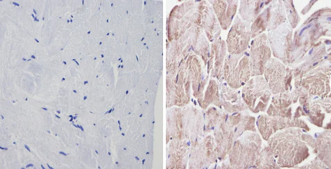 Immunohistochemistry (Formalin/PFA-fixed paraffin-embedded sections) - Anti-KAT13D / CLOCK antibody (AB3517)