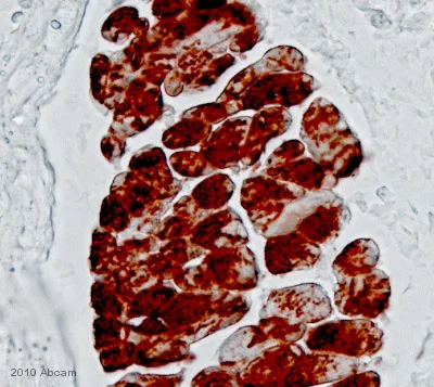 Immunohistochemistry (Formalin/PFA-fixed paraffin-embedded sections) - Anti-KAT13D / CLOCK antibody (AB3517)