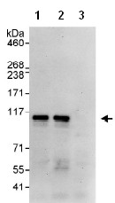 Immunoprecipitation - Anti-KAT13D / CLOCK antibody (AB93804)