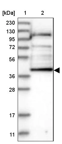 Western blot - Anti-KAT2/AadAT antibody (AB254661)