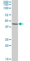 Western blot - Anti-KAT2/AadAT antibody (AB89608)