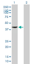 Western blot - Anti-KAT2/AadAT antibody (AB89608)