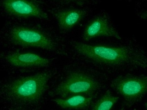 Immunocytochemistry/ Immunofluorescence - Anti-KAT2A / GCN5 antibody [AT3G13] (AB208097)