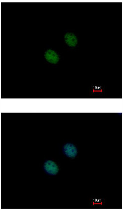 Immunocytochemistry/ Immunofluorescence - Anti-KAT2A / GCN5 antibody - C-terminal (AB153903)