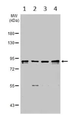 Western blot - Anti-KAT2A / GCN5 antibody - C-terminal (AB153903)