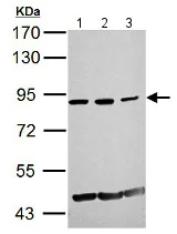 Western blot - Anti-KAT2A / GCN5 antibody - C-terminal (AB153903)