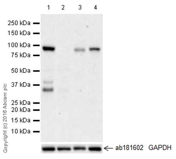 Western blot - Anti-KAT2A / GCN5 antibody [EPR21146] - BSA and Azide free (AB231075)