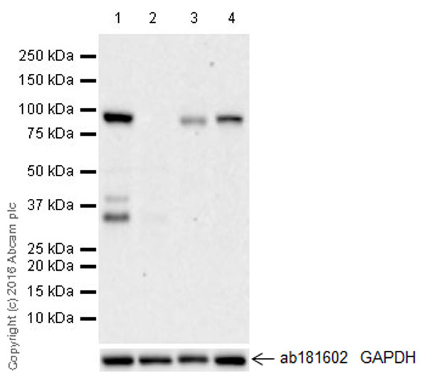 Western blot - Anti-KAT2A / GCN5 antibody [EPR21146] - ChIP Grade (AB217876), expandable thumbnail