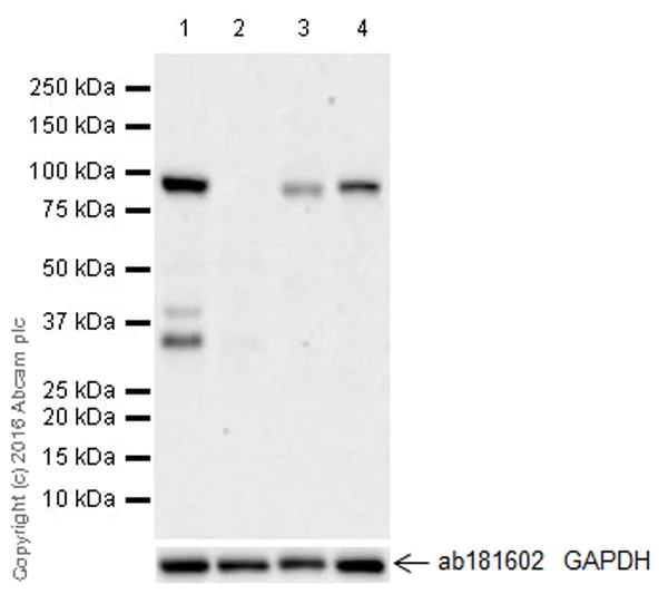 Western blot - Anti-KAT2A / GCN5 antibody [EPR21146] - ChIP Grade (AB217876)