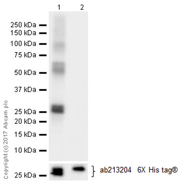 Western blot - Anti-KAT2A / GCN5 antibody [EPR21146] - ChIP Grade (AB217876), expandable thumbnail