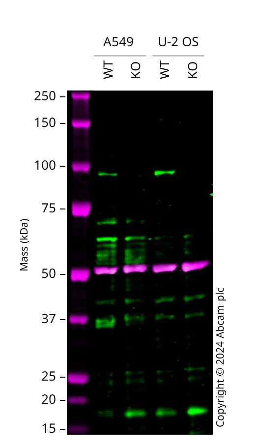 Western blot - Anti-KAT2A / GCN5 antibody [EPR21146] - ChIP Grade (AB217876)