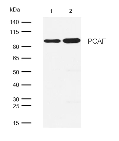 Western blot - Anti-KAT2B antibody [SR3831] (AB326697)