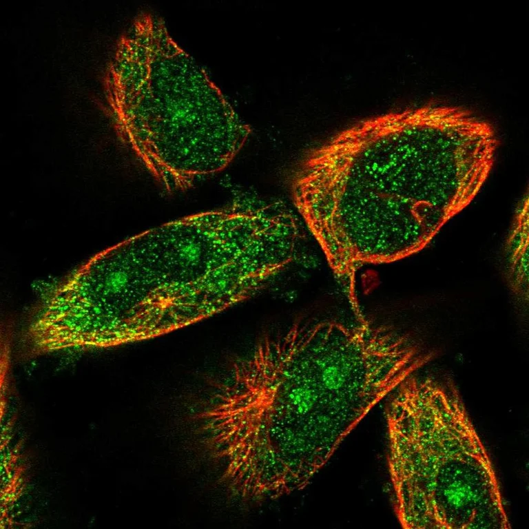 Immunocytochemistry/ Immunofluorescence - Anti-KAT3 antibody (AB246957)