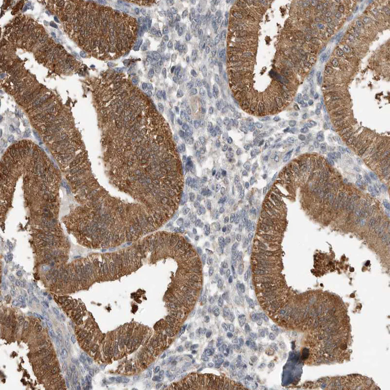 Immunohistochemistry (Formalin/PFA-fixed paraffin-embedded sections) - Anti-KAT3 antibody (AB246957)