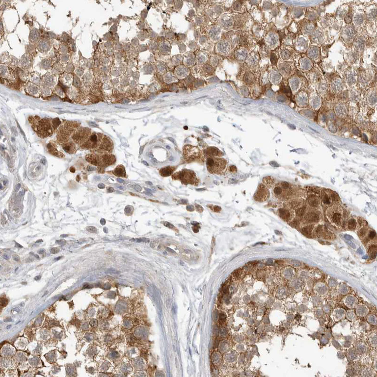 Immunohistochemistry (Formalin/PFA-fixed paraffin-embedded sections) - Anti-KAT3 antibody (AB246957)
