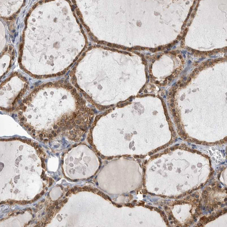 Immunohistochemistry (Formalin/PFA-fixed paraffin-embedded sections) - Anti-KAT3 antibody (AB246957)
