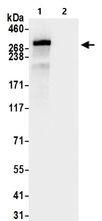 Immunoprecipitation - Anti-KAT3B / p300 antibody (AB10485)