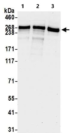 Western blot - Anti-KAT3B / p300 antibody (AB10485)