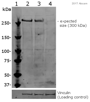 Western blot - Anti-KAT3B / p300 antibody (AB10485)
