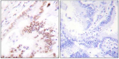 Immunohistochemistry (Formalin/PFA-fixed paraffin-embedded sections) - Anti-KAT3B / p300 antibody (AB61217)