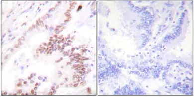 Immunohistochemistry (Formalin/PFA-fixed paraffin-embedded sections) - Anti-KAT3B / p300 antibody (AB61217)