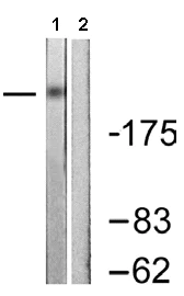 Western blot - Anti-KAT3B / p300 antibody (AB61217)