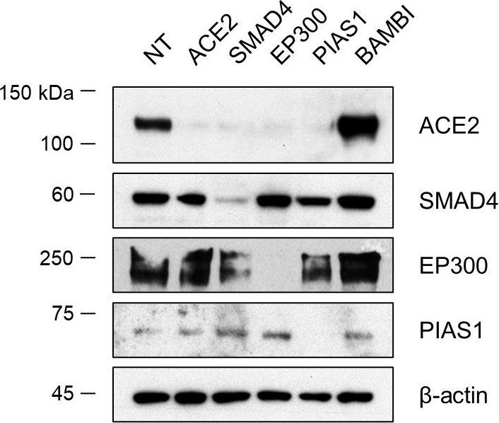 Western blot - Anti-KAT3B / p300 antibody [EPR23495-268] - ChIP Grade (ab275378), expandable thumbnail