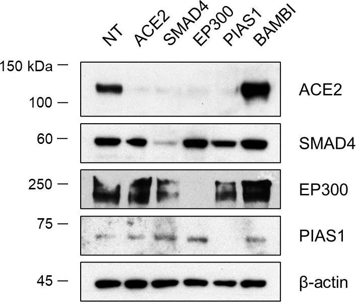 Western blot - Anti-KAT3B / p300 antibody [EPR23495-268] - ChIP Grade (AB275378)