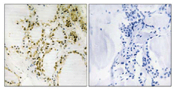 Immunohistochemistry (Formalin/PFA-fixed paraffin-embedded sections) - Anti-KAT3B / p300 (phospho S89) antibody (AB111870), expandable thumbnail