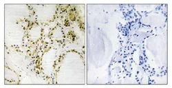 Immunohistochemistry (Formalin/PFA-fixed paraffin-embedded sections) - Anti-KAT3B / p300 (phospho S89) antibody (AB111870)