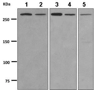 Western blot - Anti-KAT4 / TBP Associated Factor 1 antibody [EPR7145(2)] (AB168346)