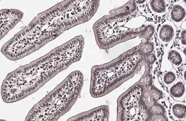 Immunohistochemistry (Formalin/PFA-fixed paraffin-embedded sections) - Anti-KAT5 / Tip60 antibody (AB137518)