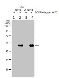 Western blot - Anti-KAT5 / Tip60 antibody (AB137518)