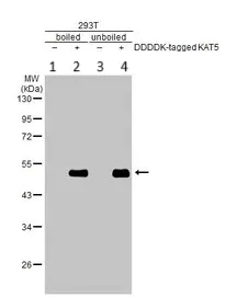 Western blot - Anti-KAT5 / Tip60 antibody (AB137518)