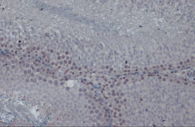 Immunohistochemistry (Formalin/PFA-fixed paraffin-embedded sections) - Anti-KAT5 / Tip60 antibody (AB151432)