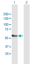 Western blot - Anti-KAT5 / Tip60 antibody (AB172415)