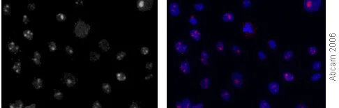 Immunocytochemistry/ Immunofluorescence - Anti-KAT5 / Tip60 antibody (AB23886)