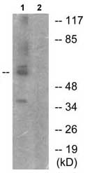 Western blot - Anti-KAT5 / Tip60 (phospho S86) antibody (AB73207)