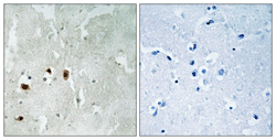 Immunohistochemistry (Formalin/PFA-fixed paraffin-embedded sections) - Anti-KAT5 / Tip60 (phospho S90) antibody (AB111588)