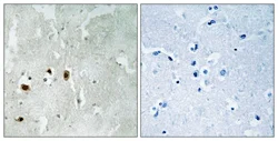 Immunohistochemistry (Formalin/PFA-fixed paraffin-embedded sections) - Anti-KAT5 / Tip60 (phospho S90) antibody (AB111588)
