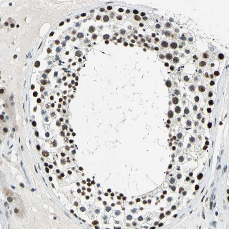 Immunohistochemistry (Formalin/PFA-fixed paraffin-embedded sections) - Anti-KAT6B / MORF antibody (AB246879)