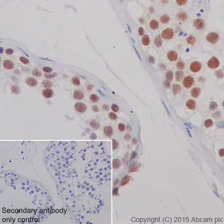 Immunohistochemistry (Formalin/PFA-fixed paraffin-embedded sections) - Anti-KAT7 / Hbo1 / MYST2 antibody [EPR18473] (AB190908)