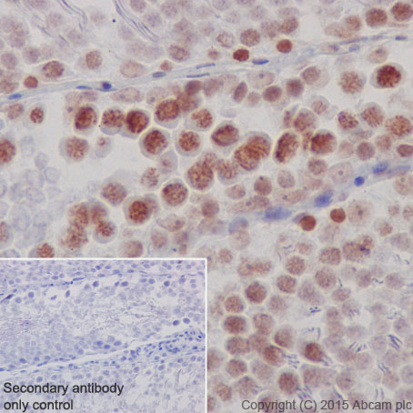 Immunohistochemistry (Formalin/PFA-fixed paraffin-embedded sections) - Anti-KAT7 / Hbo1 / MYST2 antibody [EPR18473] - BSA and Azide free (AB240315), expandable thumbnail
